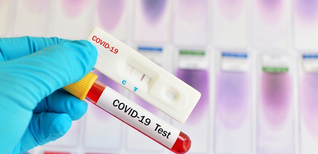 Αρνητικά όλα τα rapid tests στο Δημαρχείο 