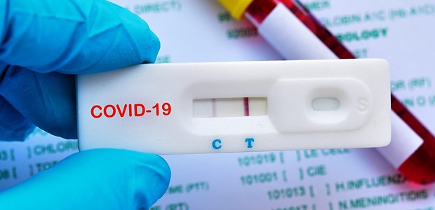 Πού θα γίνουν δωρεάν rapid tests το Σάββατο
